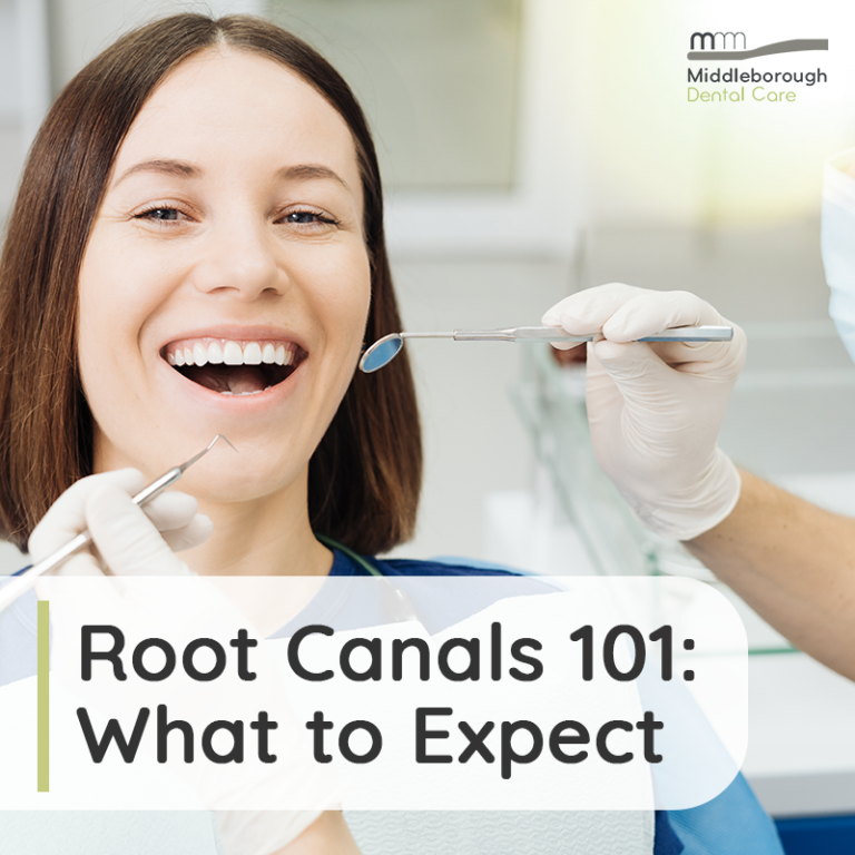 10 Fast Facts About Root Canals Everything You Should Know About Root